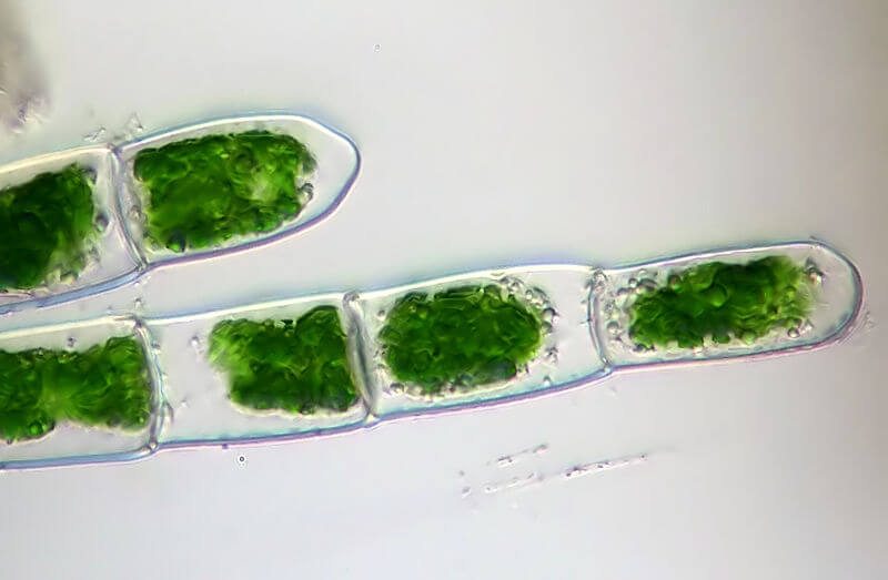 800px-green_algae_ manage algae in aquaponics microscope